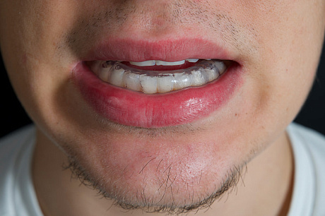 Капа для фитнеса и тяжелой атлетики